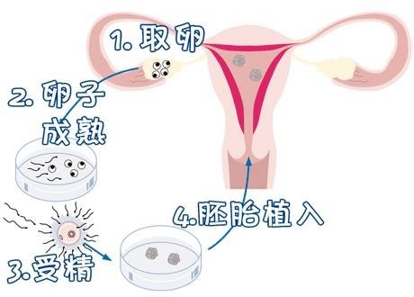 高齢初産